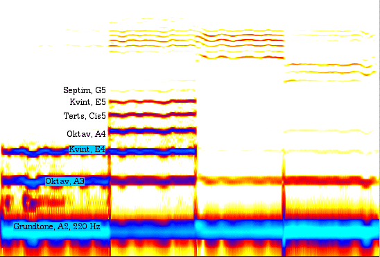 sonogram