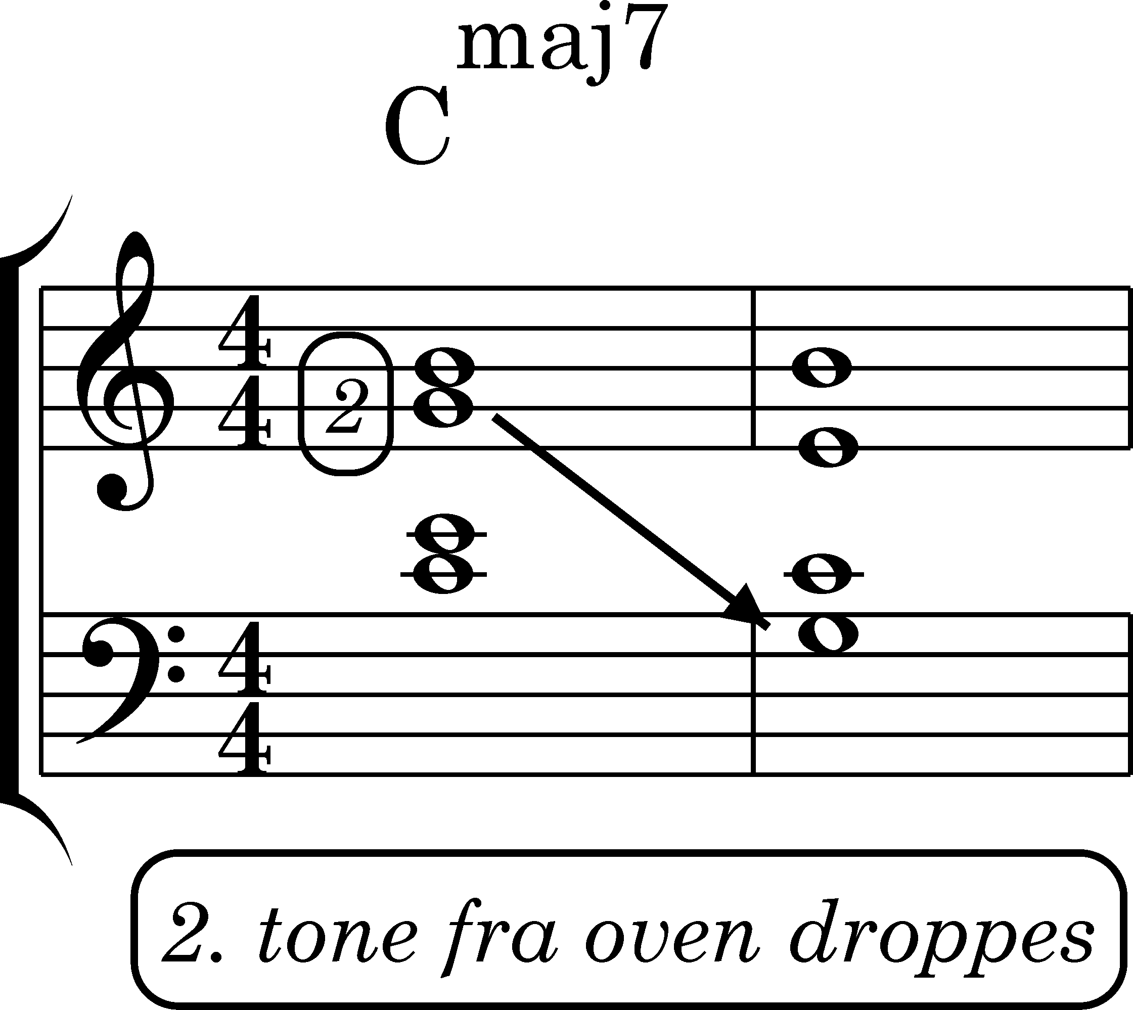 node