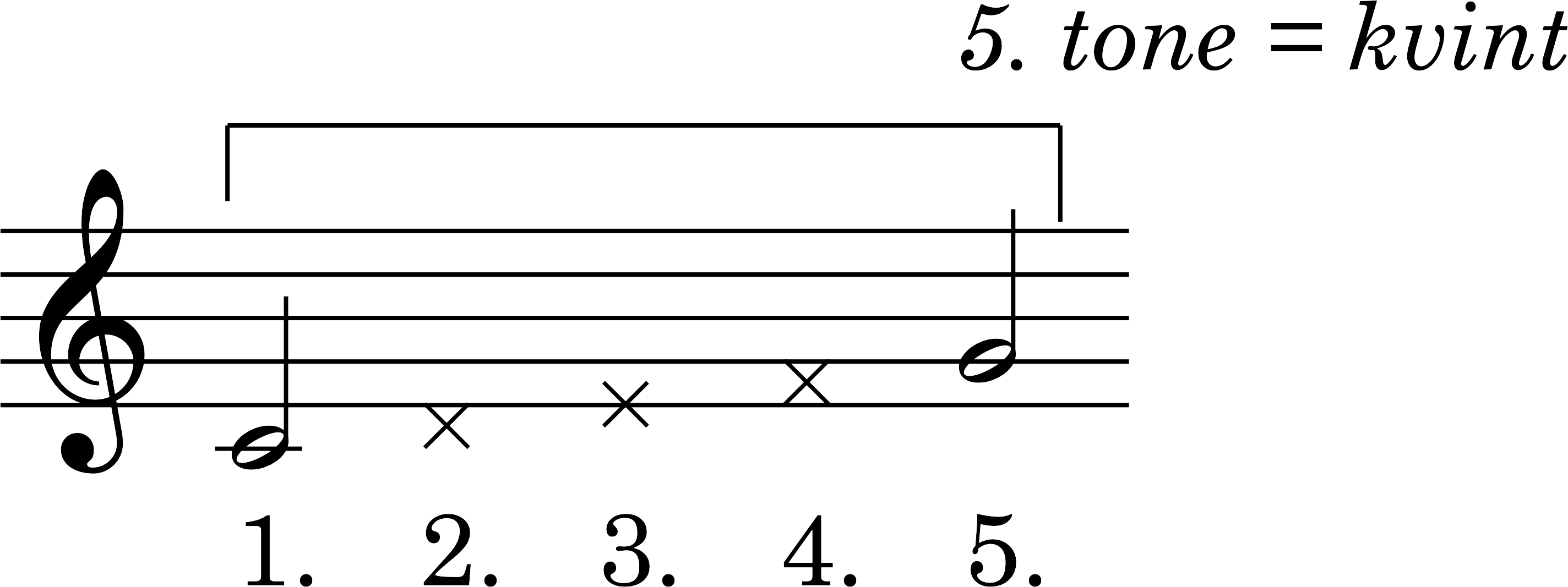 Node